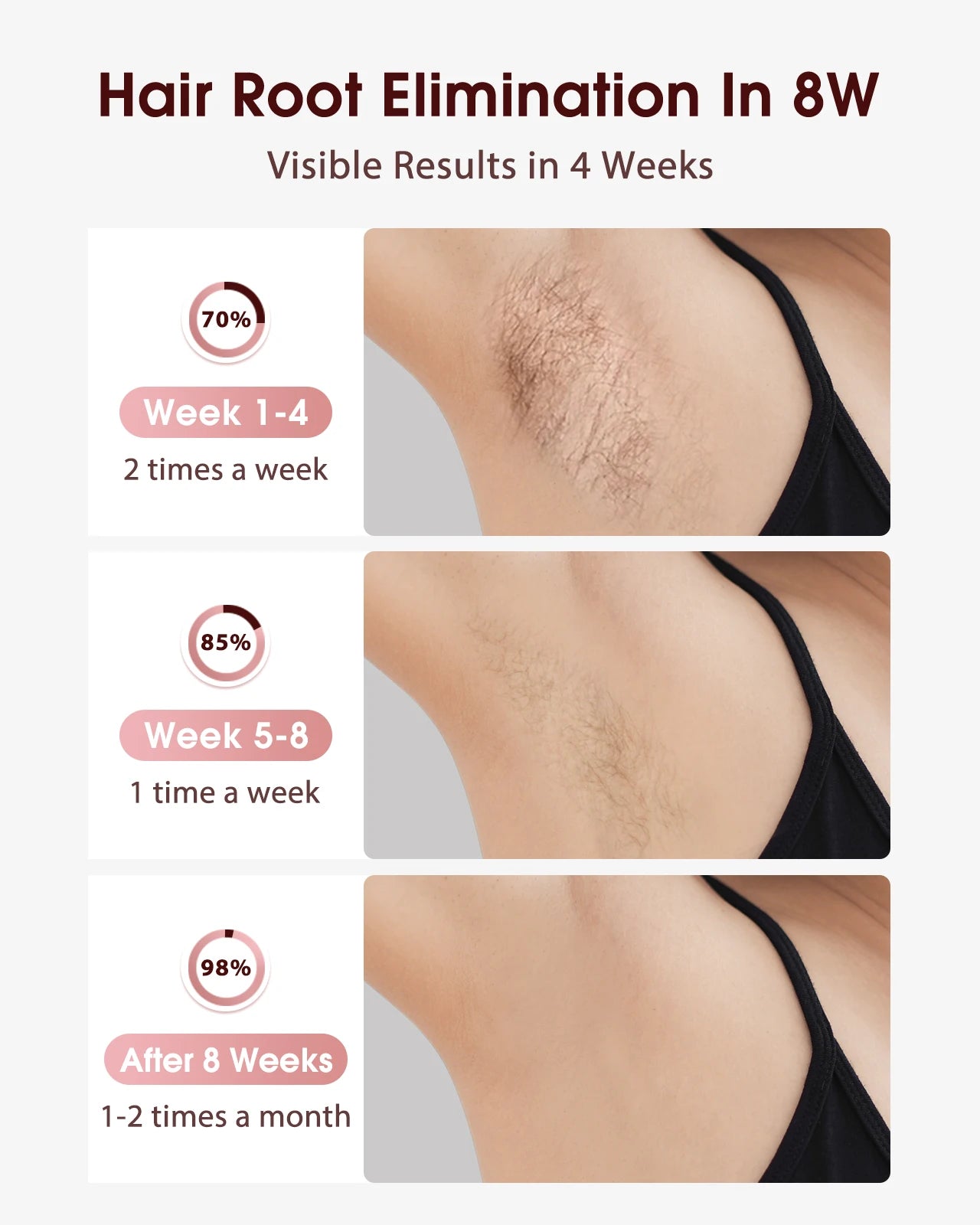Selfika™ Ice-Cooling IPL Hair Removal Handset with 999900 Flashes
