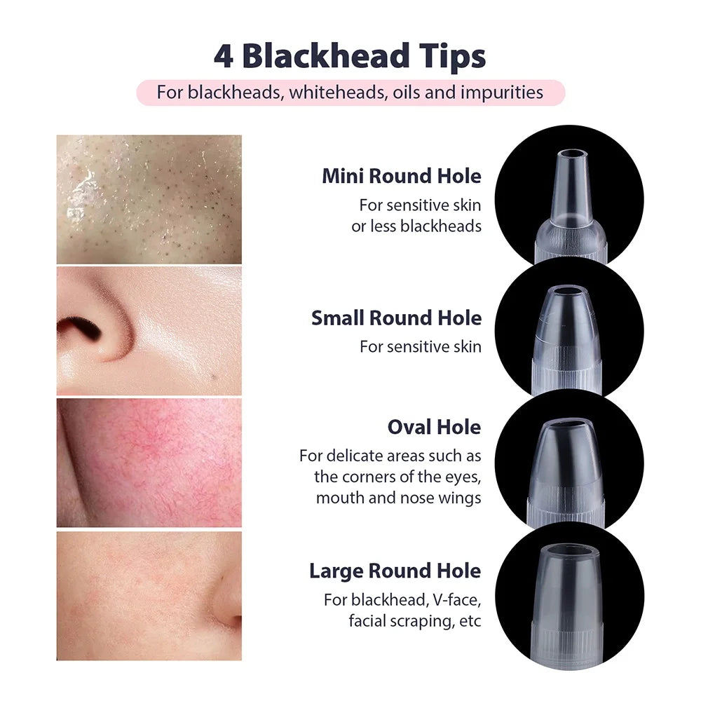 Selfika™ Diamond Microdermabrasion Machine Facial Peeling Device