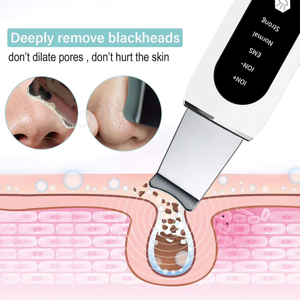peicon Ultrasonic Skin Scrubber – Deep Face Cleaning, Blackhead Remover, EMS Ion Facial Spatula