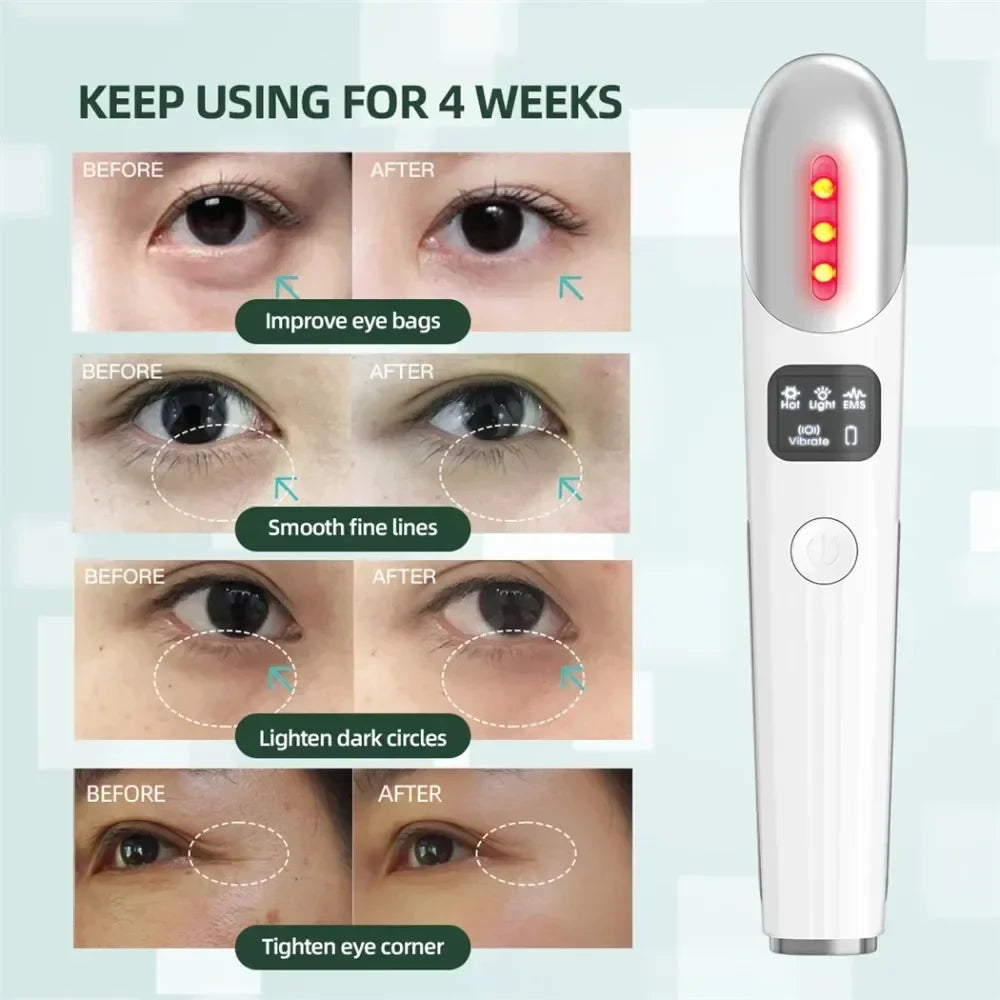 miitina EMS Microcurrent Facial Wand – Red Light, Heat, Vibration, Anti-Wrinkle Appearance, USB Rechargeable