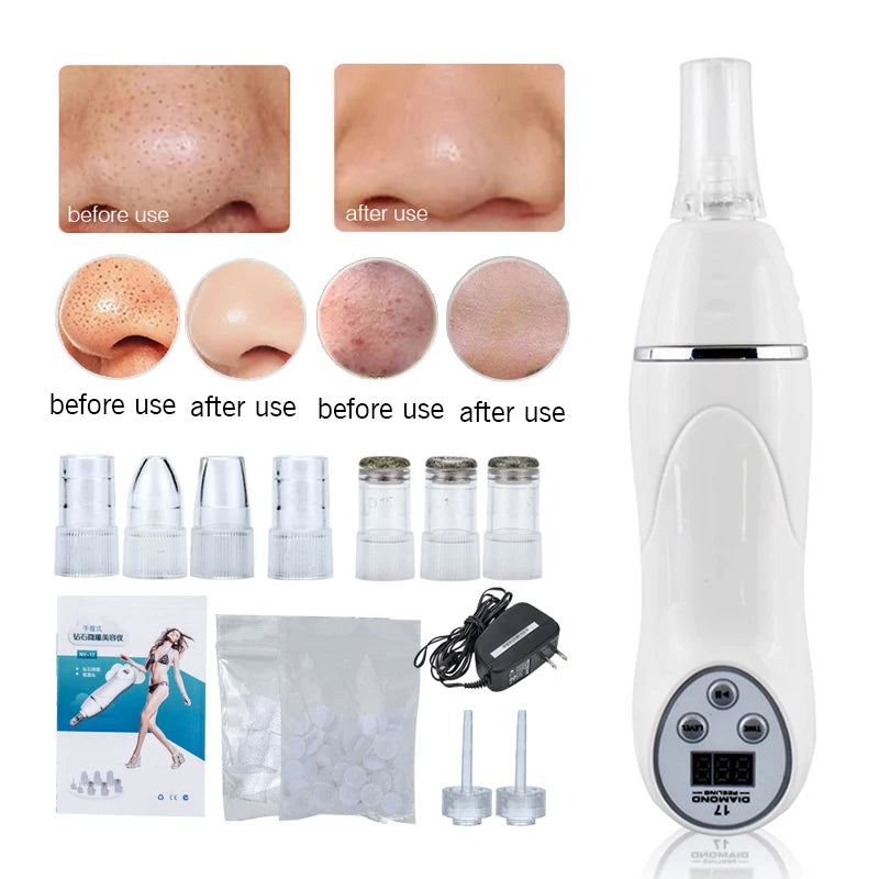 Selfika™ Diamond Microdermabrasion Machine Vacuum Pore Cleaner