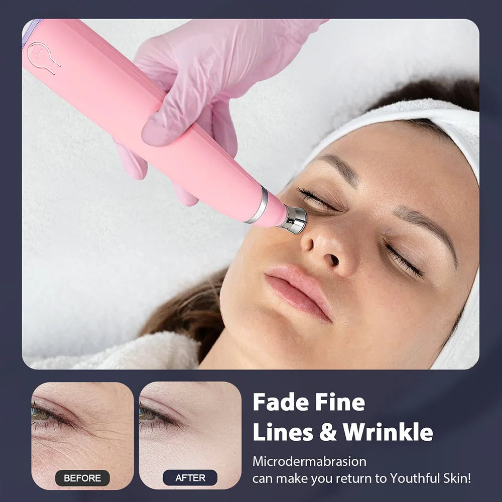 Selfika™ Diamond Microdermabrasion Machine Facial Peeling Device