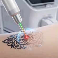 Selfika™ 808nm 2-in-1 Diode Laser Hair & Tattoo Removal Machine