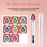 miitina 7-Color LED EMS Microcurrent Eye Massager – Anti-Wrinkle Appearance, Heated, USB Rechargeable