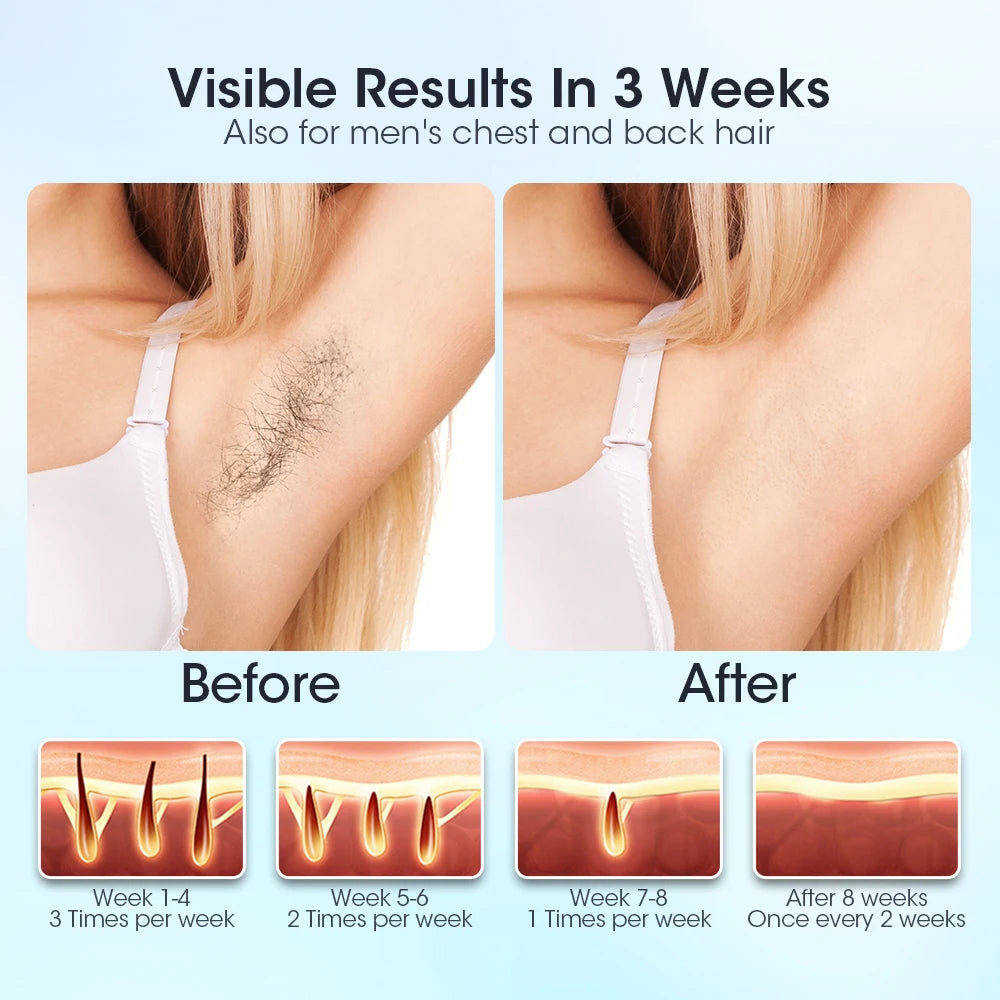 Selfika™ 3-in-1 Handheld IPL Laser Hair Removal Device T14