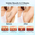 Selfika™ 3-in-1 Handheld IPL Laser Hair Removal Device T14