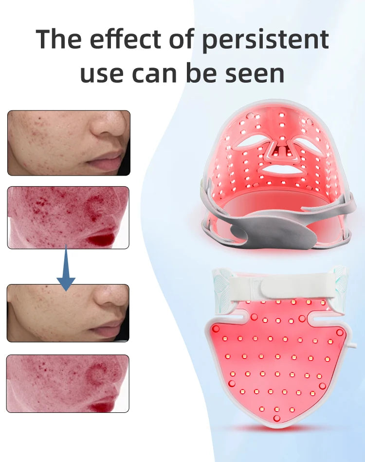 UBilli 8-Color + IR Silicone LED Face & Neck Mask – Light Therapy, Anti-Aging Appearance, Acne Control