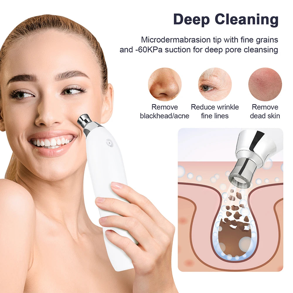 Selfika™ 2-in-1 Diamond Microdermabrasion Machine