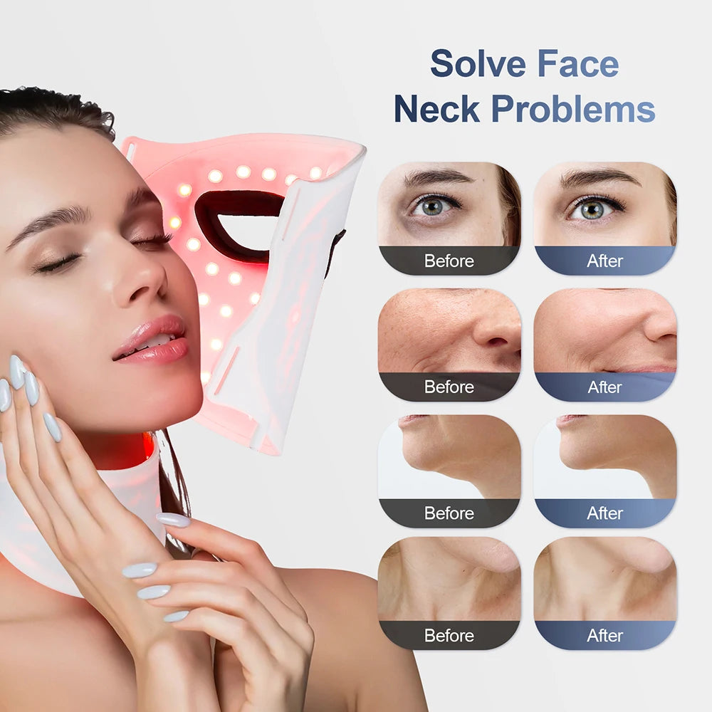 foreverlily Silicone 7-Color LED Face & Neck Mask – Wireless, Anti-Aging Appearance, Skin Rejuvenation