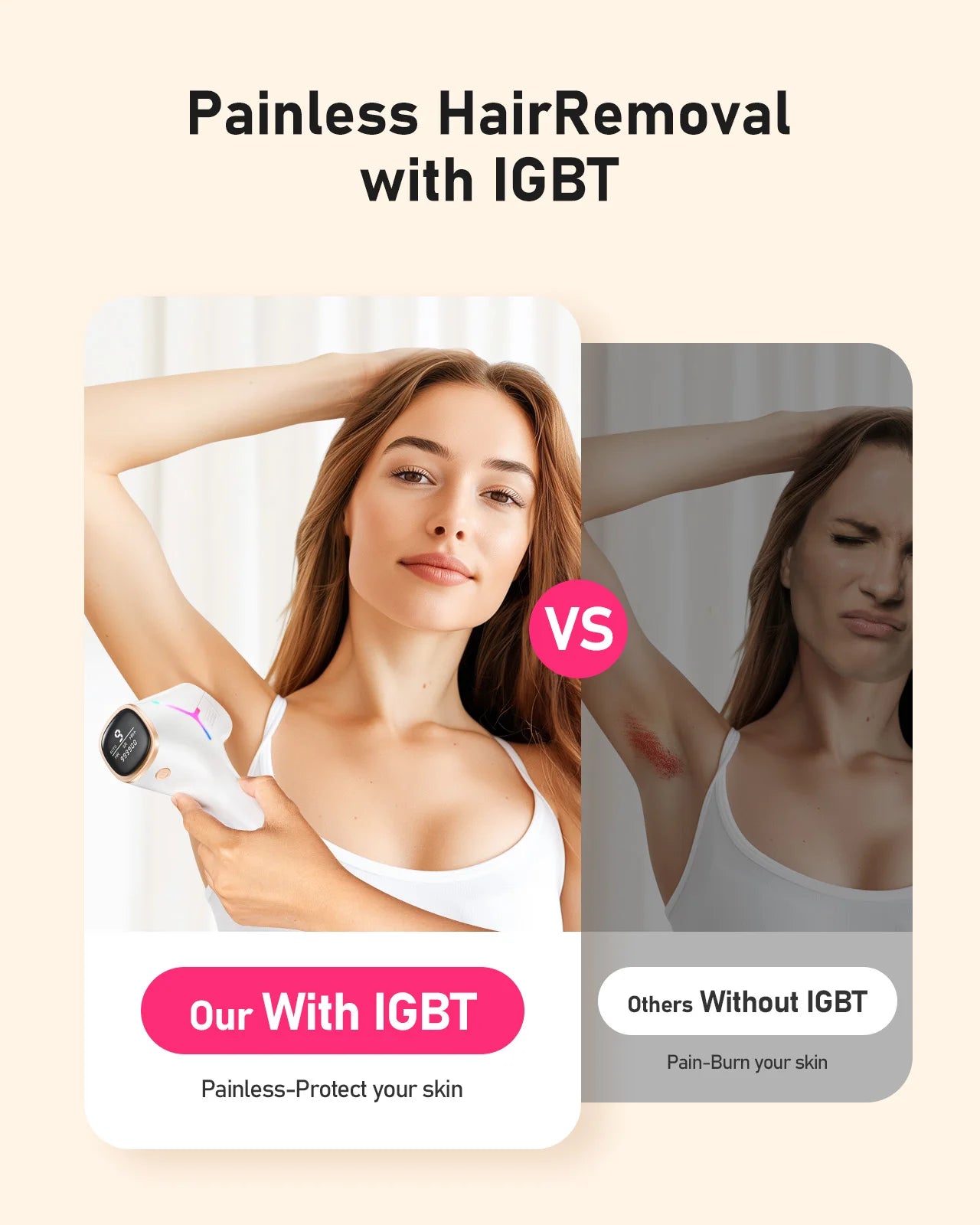 Selfika™ IPL Hair Removal Device 9 Energy Levels 22J Epilator