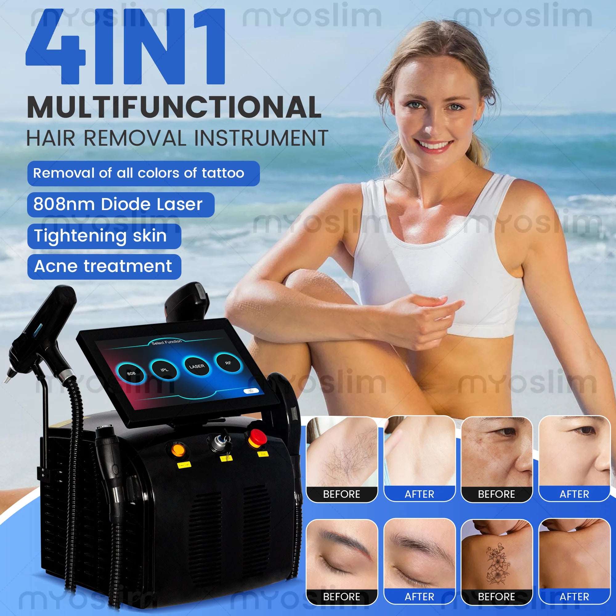 Selfika™ 4-in-1 Multifunctional Diode Laser Beauty Machine