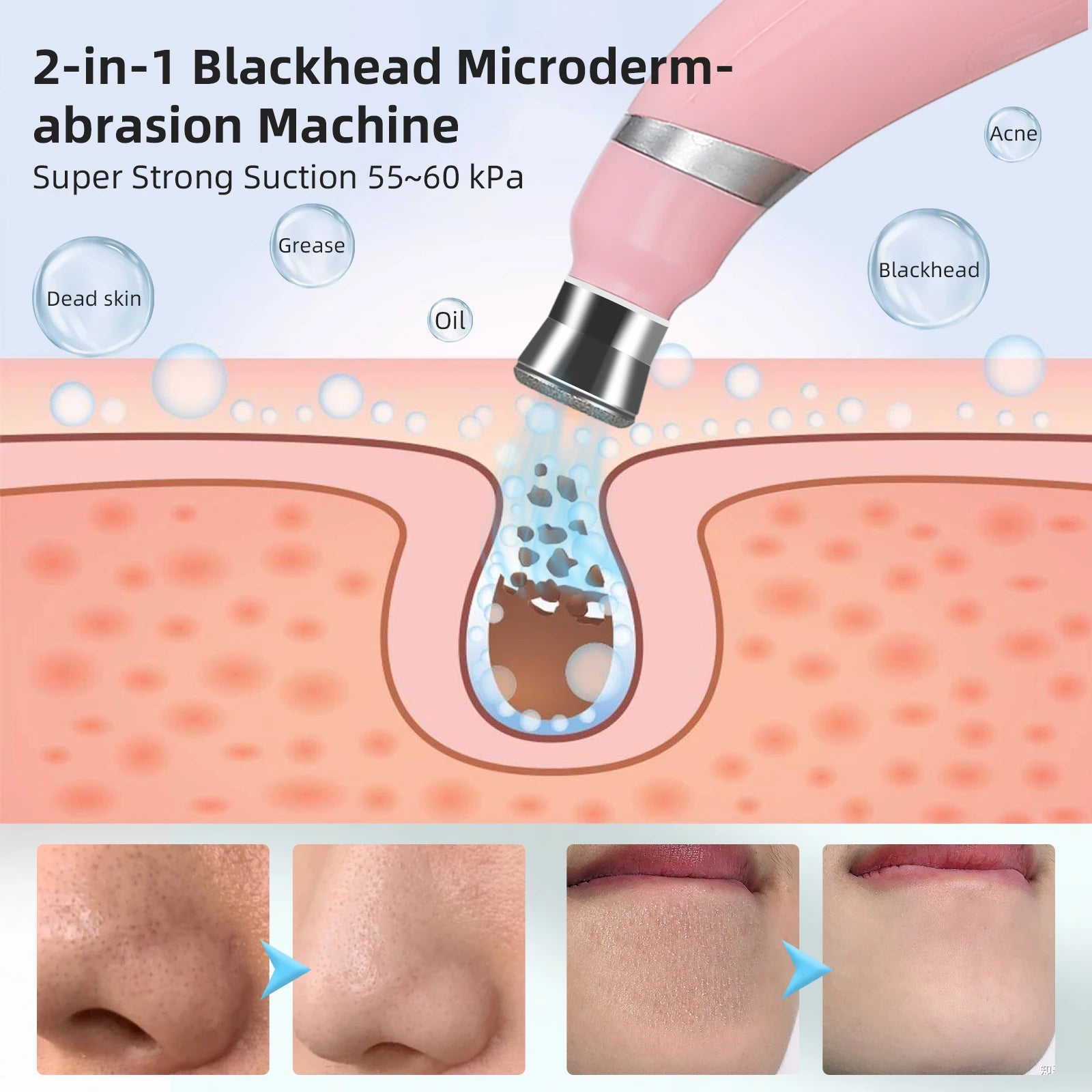 Selfika™ Diamond Microdermabrasion Machine Facial Peeling Device