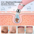 Selfika™ Diamond Microdermabrasion Machine Facial Peeling Device