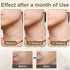 peicon EMS Microcurrent Neck & Face Lifting Massager – Red Light, Heat, Anti-Aging Appearance Device
