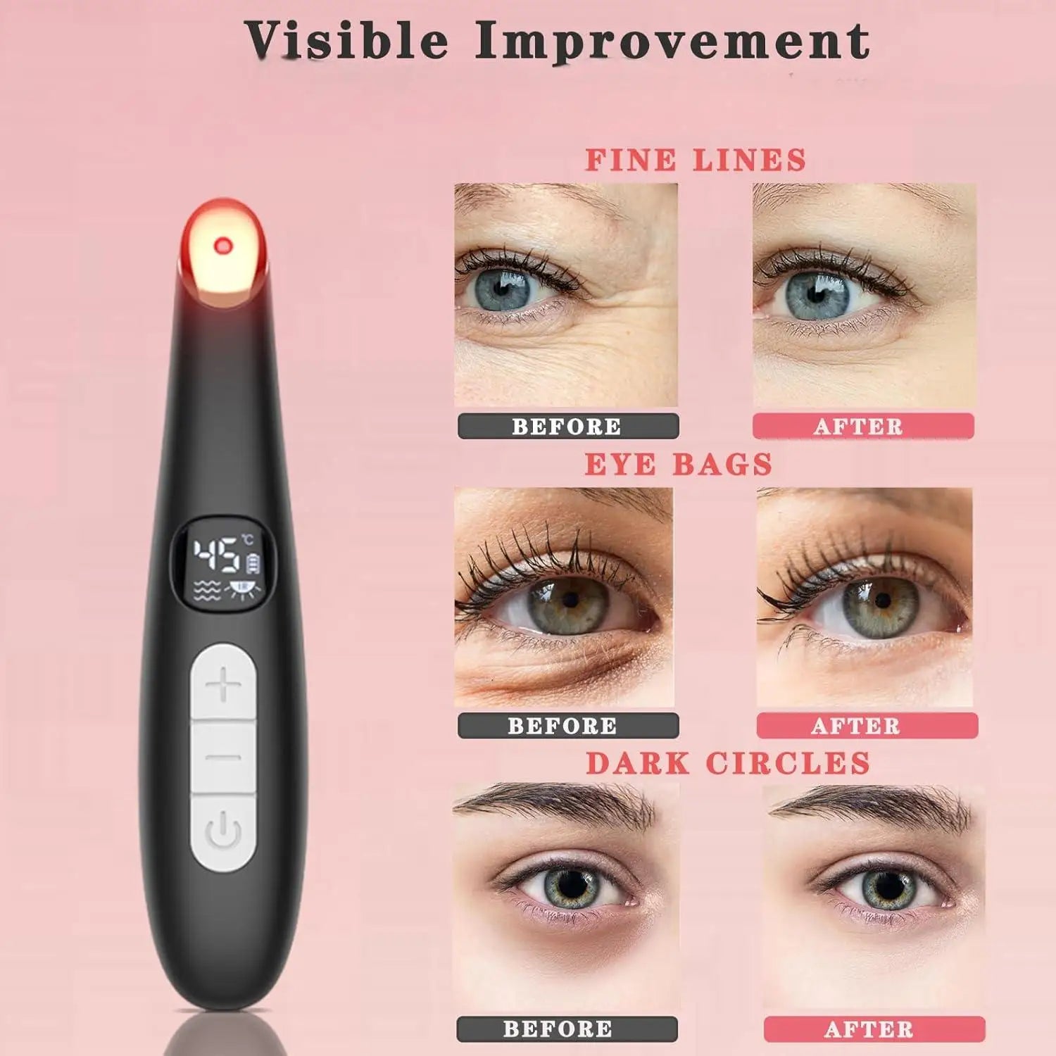 VIMYSHOW 3-in-1 Eye & Face Lift Wand – Red Light, Heat Therapy, ION, USB Rechargeable Massager