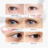 vilnason 3D Visual Eye Massager – Red Light, EMS Micro-Current, Heat for Dark Circle Appearance and Relaxation