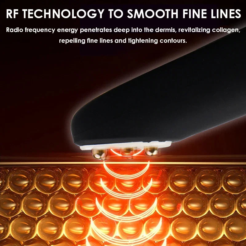 miitina Electric RF EMS Eye Massager Pen – Red Light, Vibration, USB Rechargeable Anti-Wrinkle Appearance