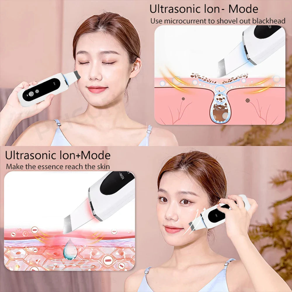 peicon Ultrasonic Skin Scrubber – Deep Face Cleaning, Blackhead Remover, EMS Ion Facial Spatula