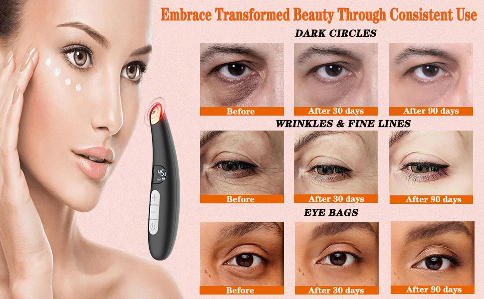 VIMYSHOW 3-in-1 Eye & Face Lift Wand – Red Light, Heat Therapy, ION, USB Rechargeable Massager