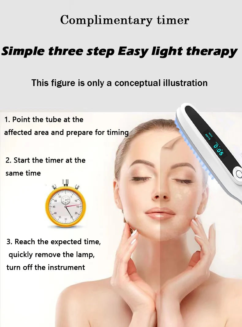 GLENN Handheld UV Narrow Band Light Source (311nm) – Cosmetic Skin Device, USB Powered