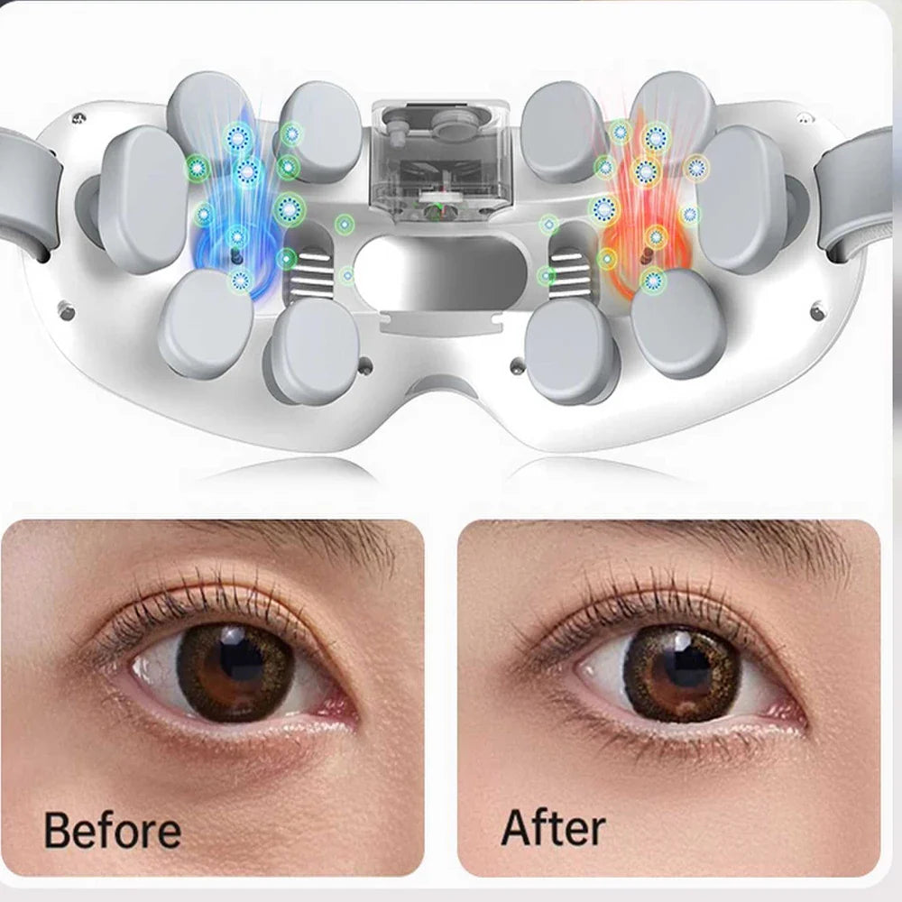 vilnason Advanced Nebulization Eye Massager – Hot and Cold Mist, Vibration, Bluetooth Music Relaxation Device