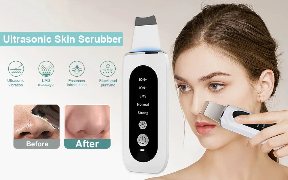 peicon Ultrasonic Skin Scrubber – Deep Face Cleaning, Blackhead Remover, EMS Ion Facial Spatula