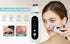 peicon Ultrasonic Skin Scrubber – Deep Face Cleaning, Blackhead Remover, EMS Ion Facial Spatula