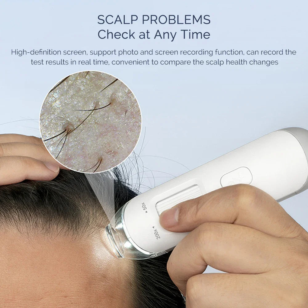 iebilif Hair Follicle Scalp Detector – 50X-200X Digital Analyzer, USB Powered for Home Use