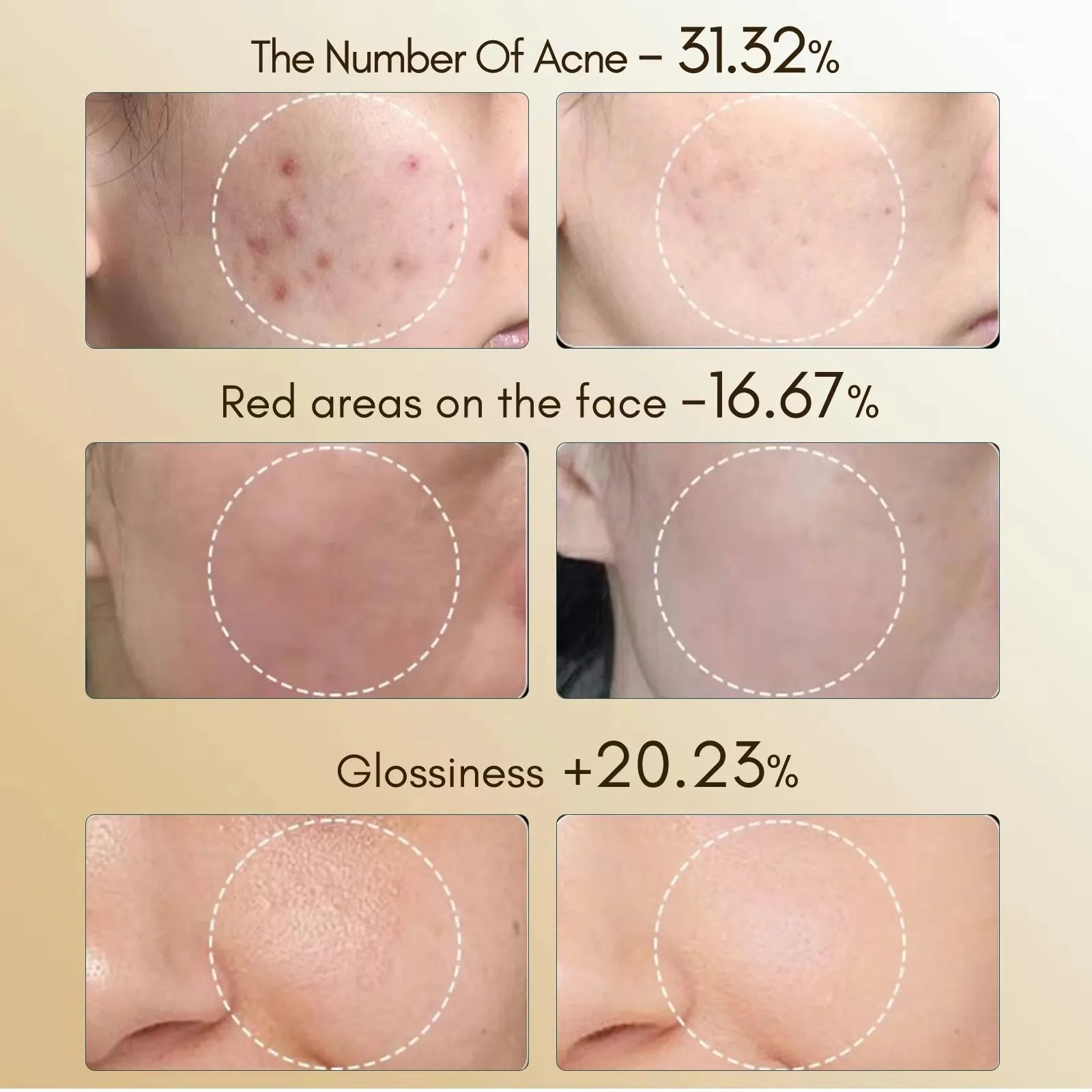 vilnason Silicone 7-Color LED Face Mask – Wireless, Red Light Therapy, Anti-Aging Appearance