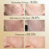 vilnason Silicone 7-Color LED Face Mask – Wireless, Red Light Therapy, Anti-Aging Appearance