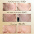 vilnason Silicone 7-Color LED Face Mask – Wireless, Red Light Therapy, Anti-Aging Appearance