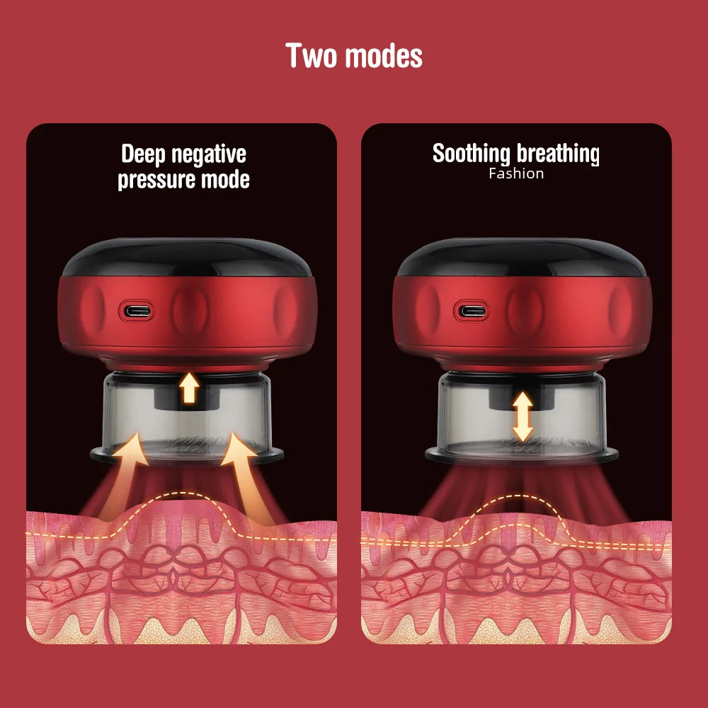 Selfika™ Intelligent Electric Vacuum Cupping Massager – 12-Level Red Light Heating & Dynamic Suction Device for Gua Sha and Pain Relief