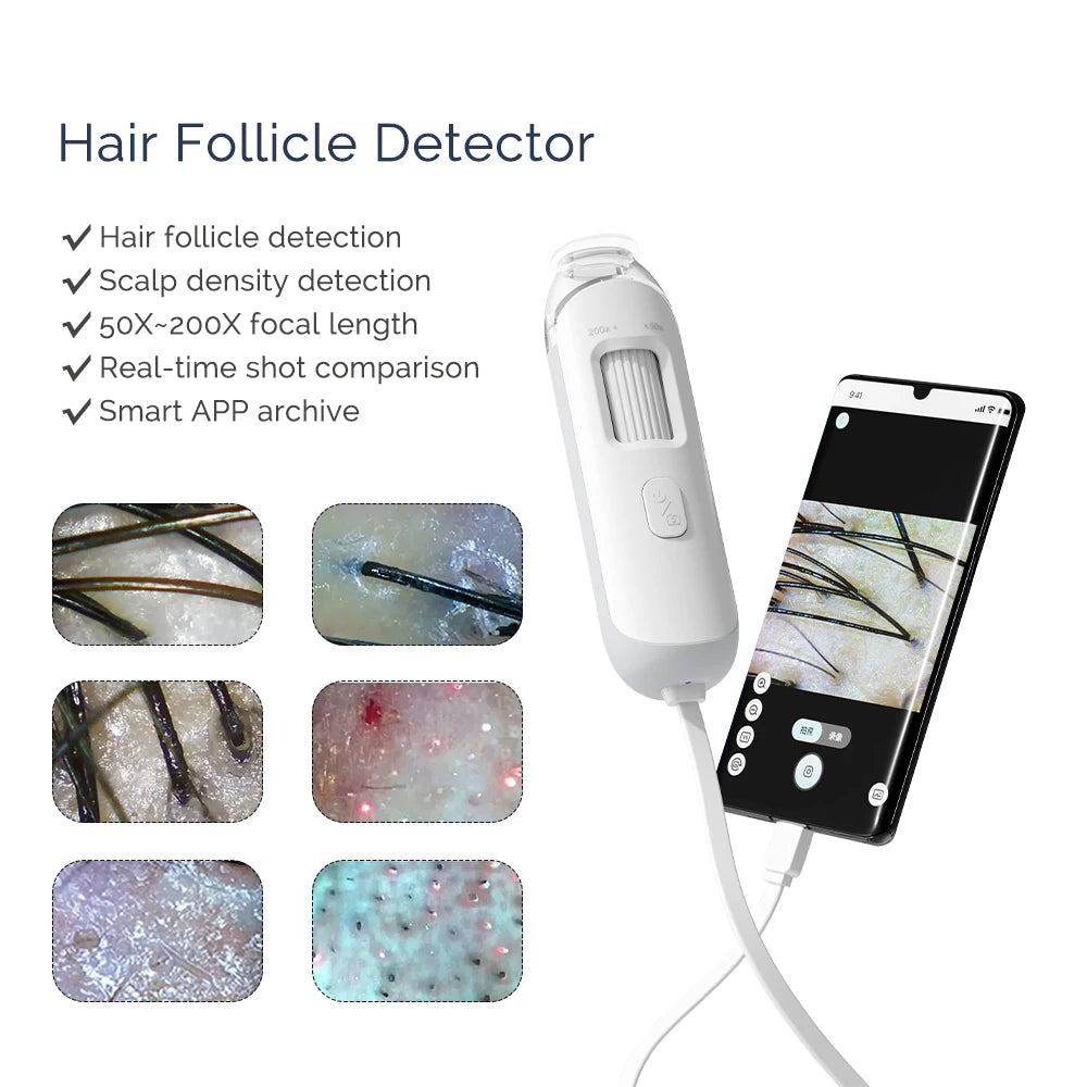 iebilif Hair Follicle Scalp Detector – 50X-200X Digital Analyzer, USB Powered for Home Use
