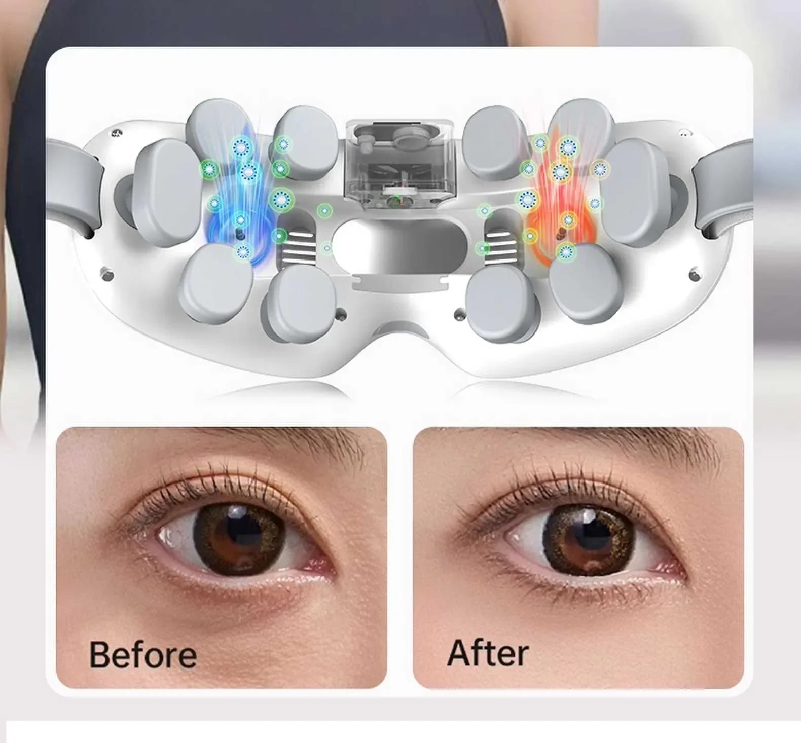 vilnason Advanced Nebulization Eye Massager – Hot and Cold Mist, Vibration, Bluetooth Music Relaxation Device