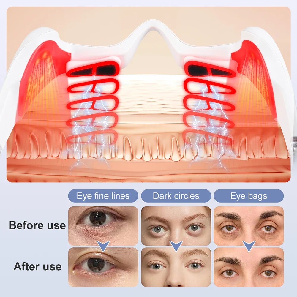 foreverlily Electric Eye Massager Glasses – EMS Microcurrent, Red Light, Warmth, Fatigue Relief