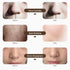 iebilif Rechargeable 7-Color LED Photon Face & Neck Mask – Skin Rejuvenation, Facial Beauty SPA