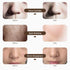 iebilif Rechargeable 7-Color LED Photon Face & Neck Mask – Skin Rejuvenation, Facial Beauty SPA