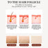 Selfika™ 808nm Diode Laser Hair Removal Handle